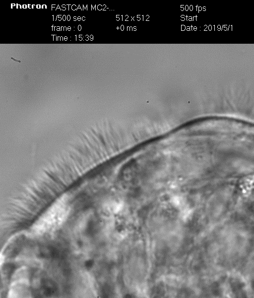 Биение ресничек у больного ПЦД – видео 2
