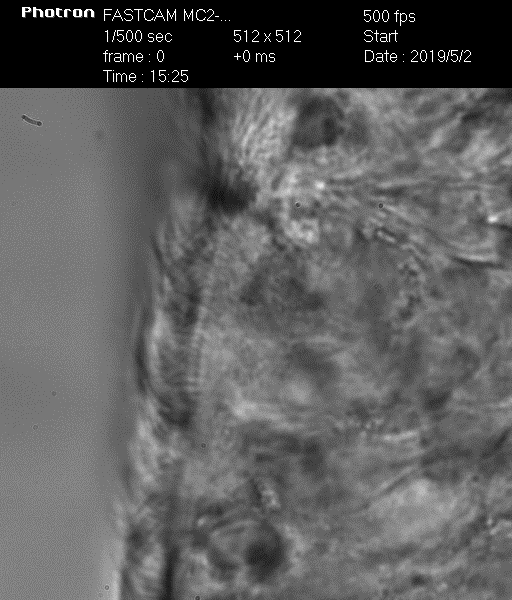 Биение ресничек у здорового – видео 1 